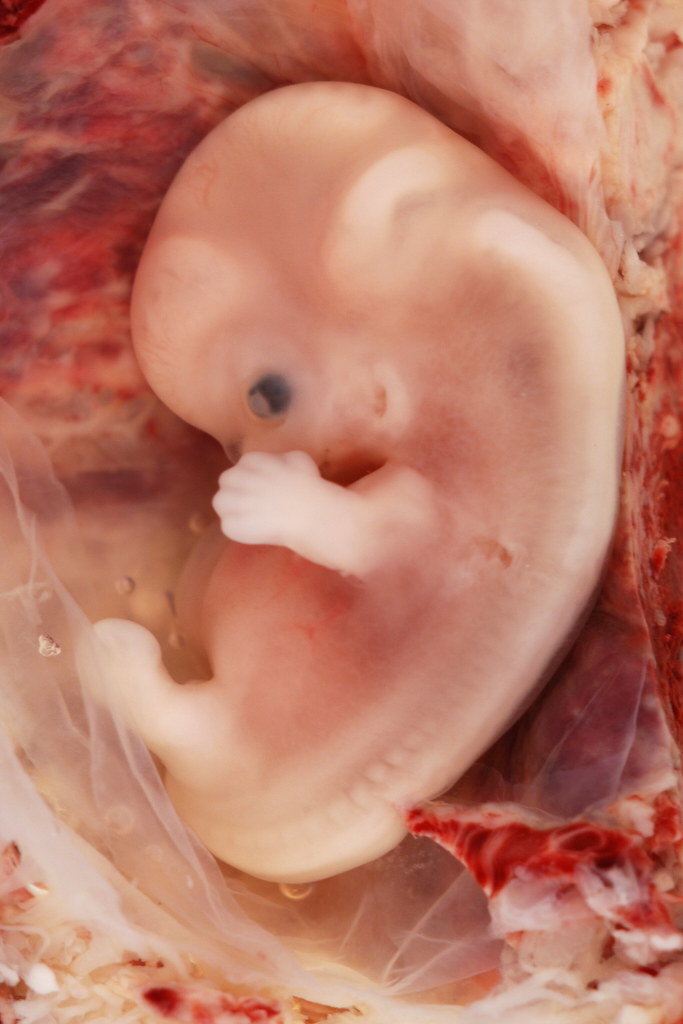 Image result for chordate fetuses