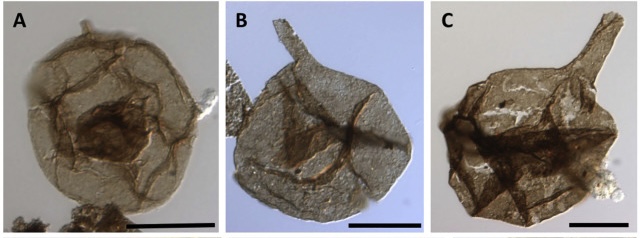 Examples of 3 Neoproterozoic acritarchs, which are possible algal resting cysts.